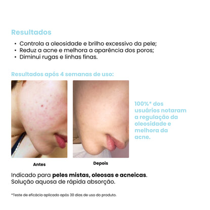 Tônico Antioleosidade Creamy - Ácido Salicílico